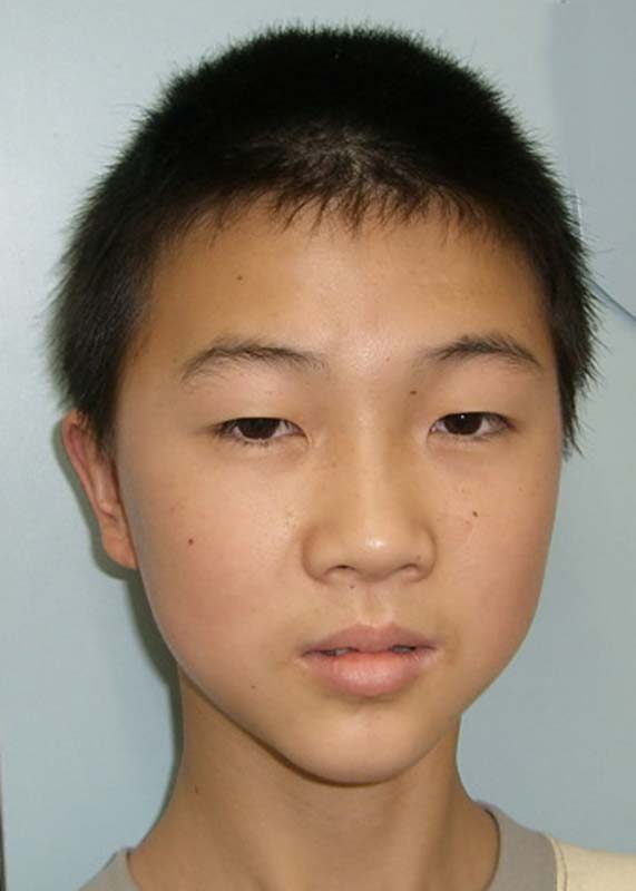 郭灶新 Guo Zao Xin