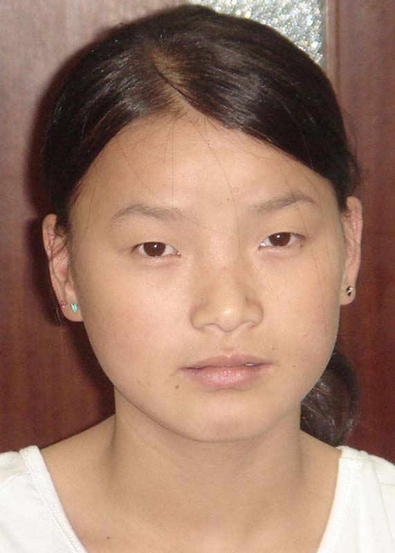 储笑媚 Chu Xiao Mei