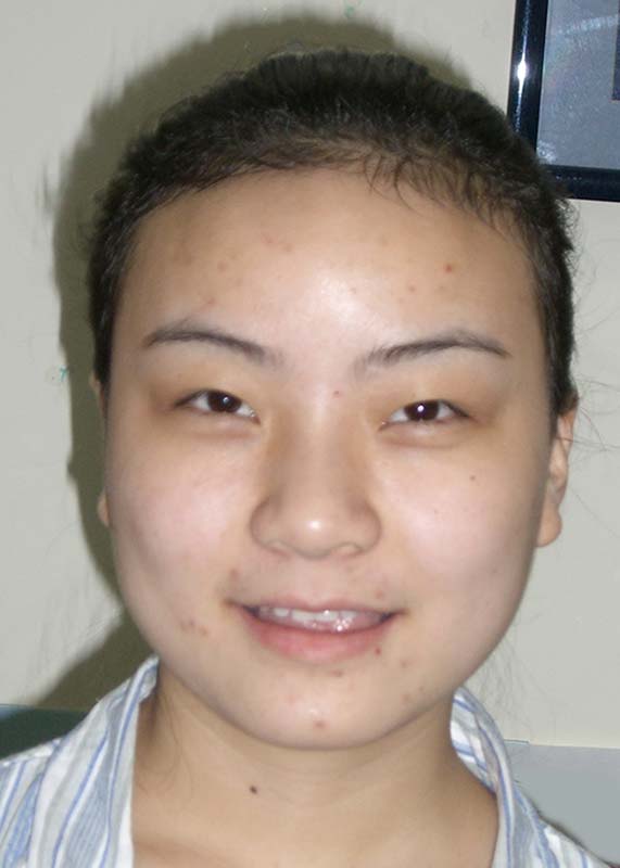 杨晓桑 Yang Xiao Sang