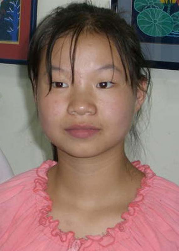 王娅琼 Wang Ya Qiong