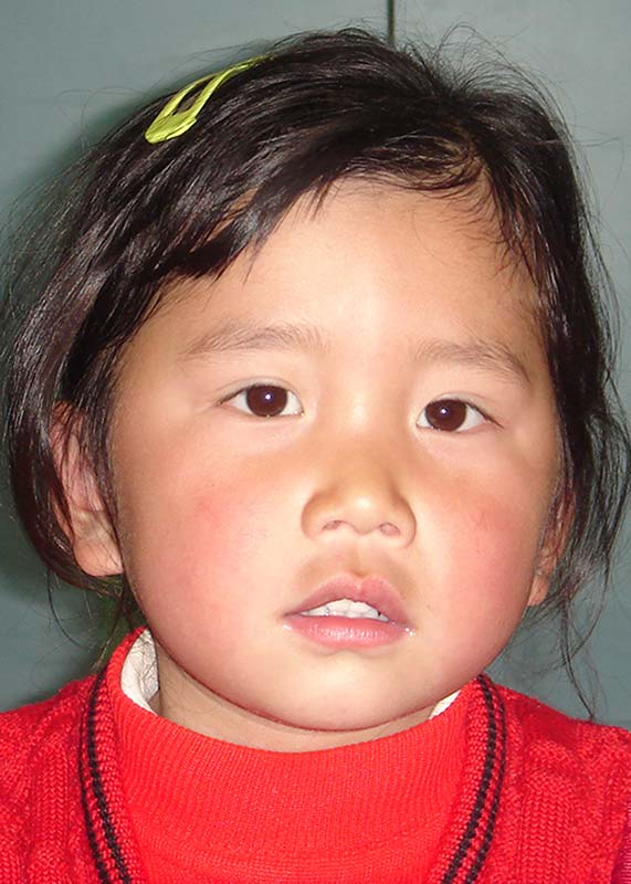 王伟琴 Wang Wei Qin