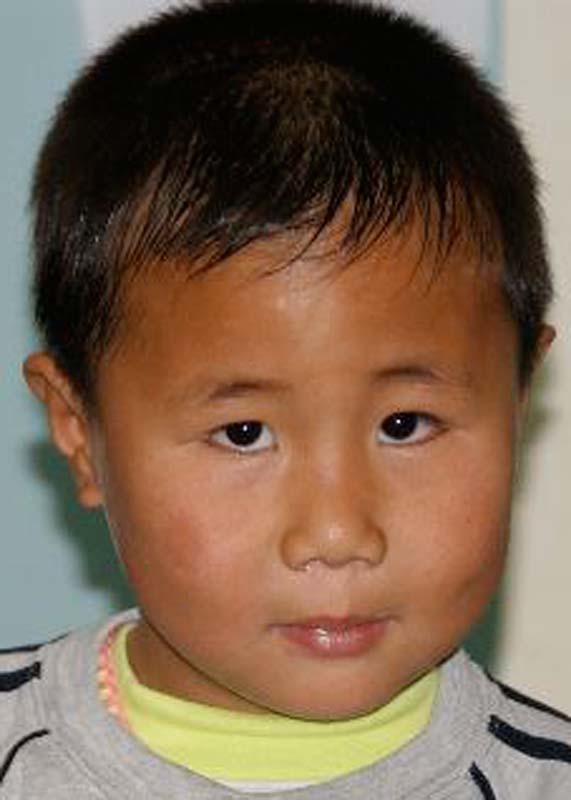 张向阳 Zhang Xiang Yang