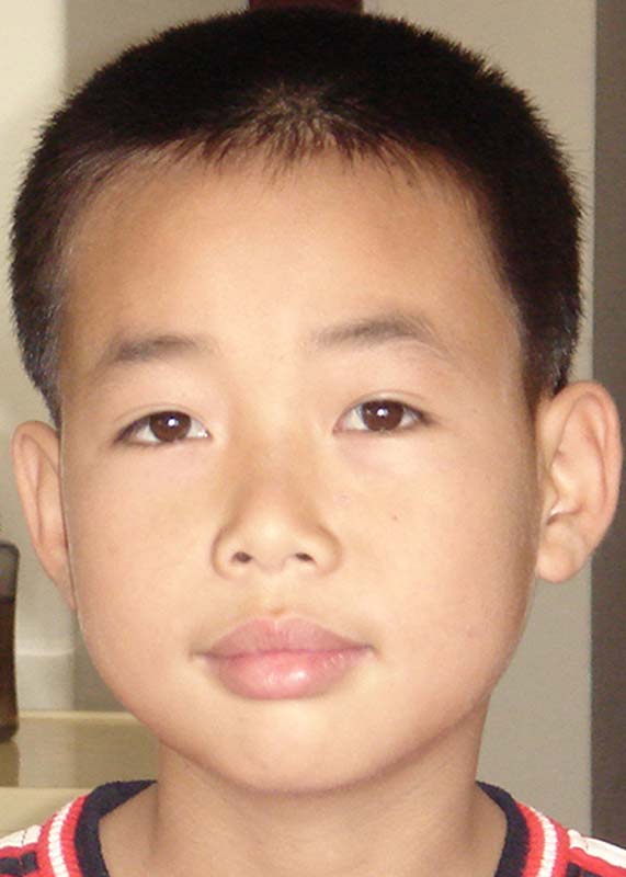 刘锋 Liu Feng
