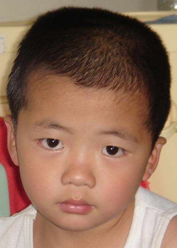 陈俊 Chen Jun