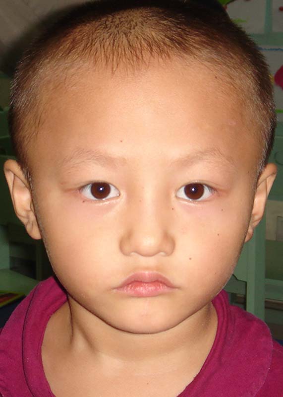 邹春蕾 Zou Chen Lei