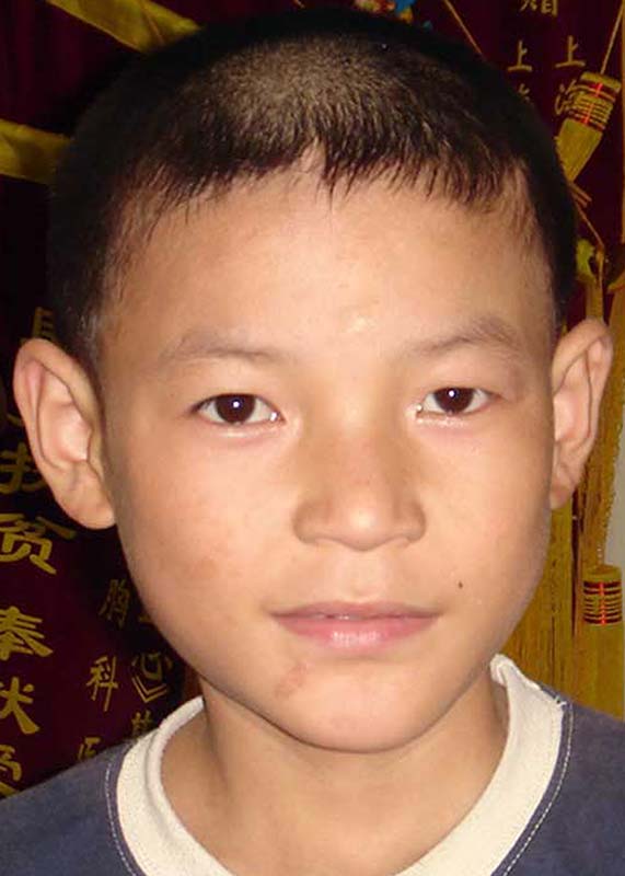 胡霞鑫 Hu Xia Xin