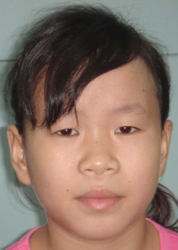 Huang Ting
