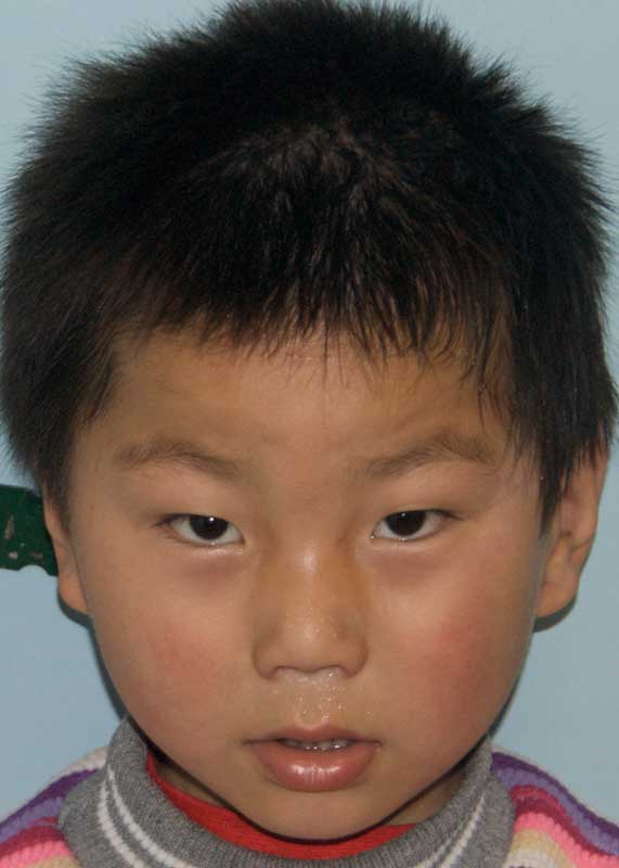 Li Jin Bao