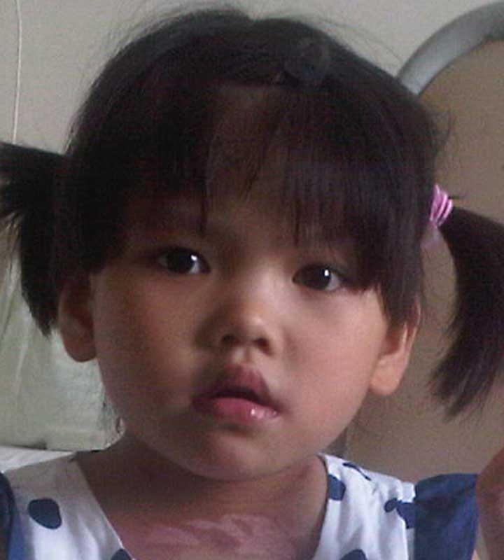 Liu Hui Ting