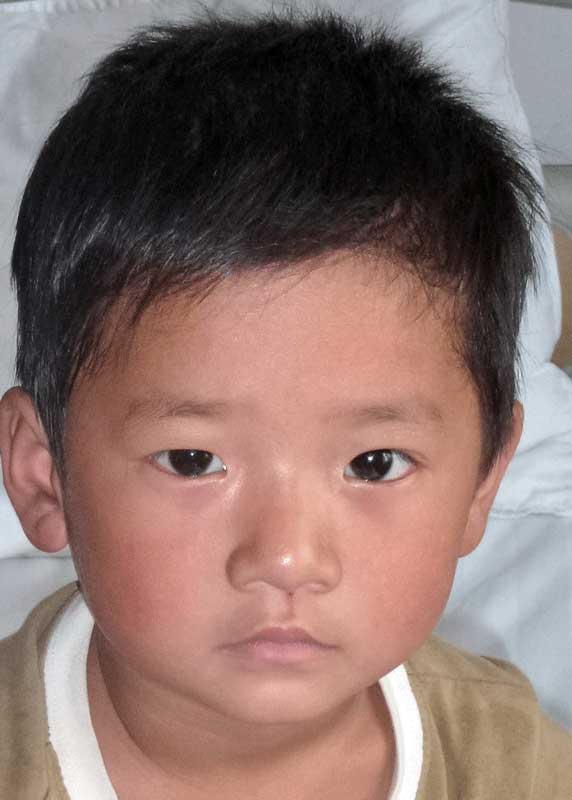 Zhang  Chen